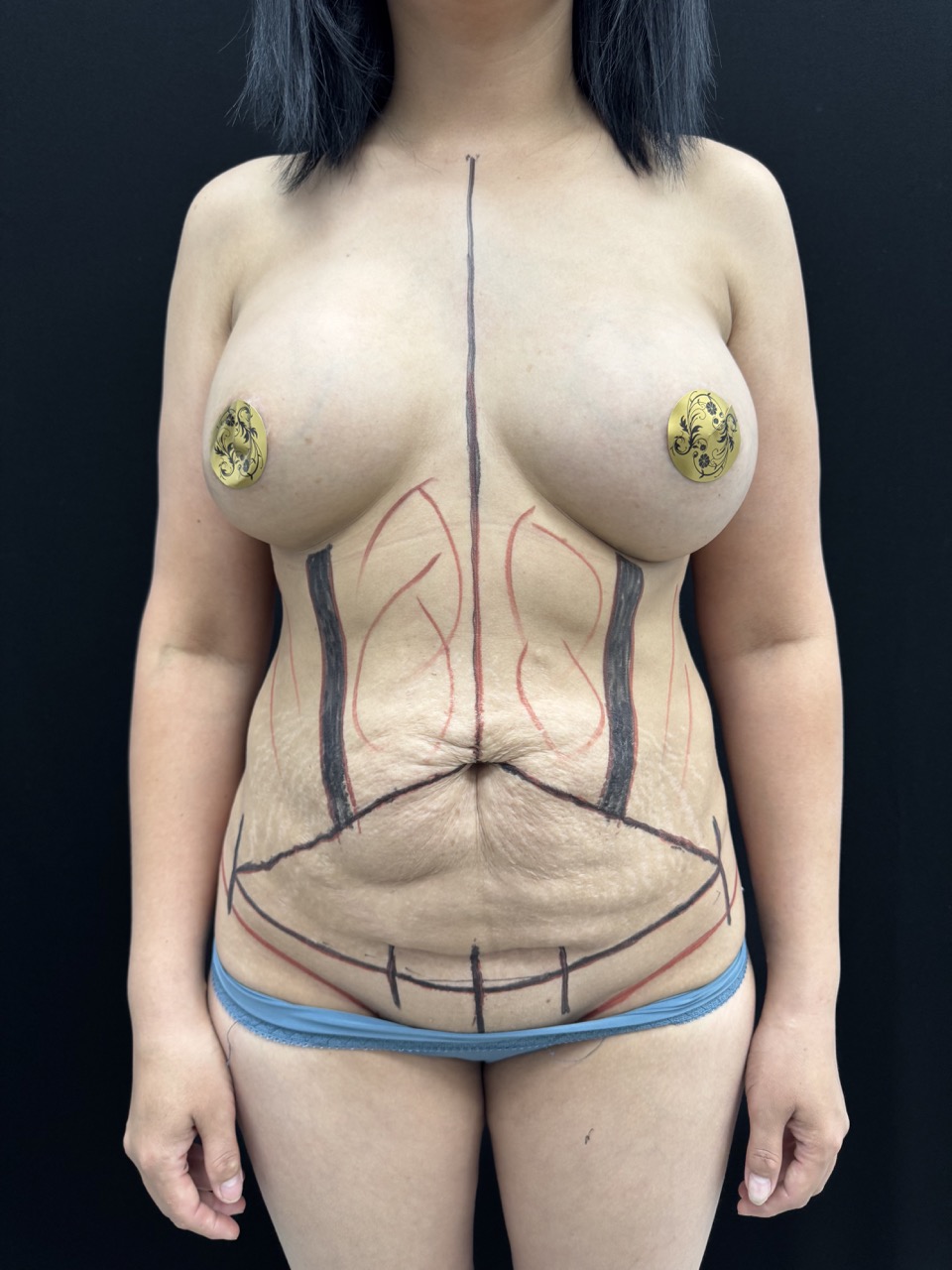 Результат работы 5 (после)